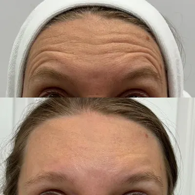 Medycyna Estetyczna - Dr n. med. Agnieszka Bogacz-Piaseczyńska